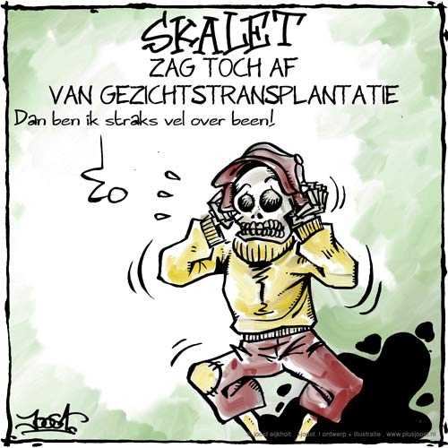 Skalet zag toch af van gezichtstransplantatie